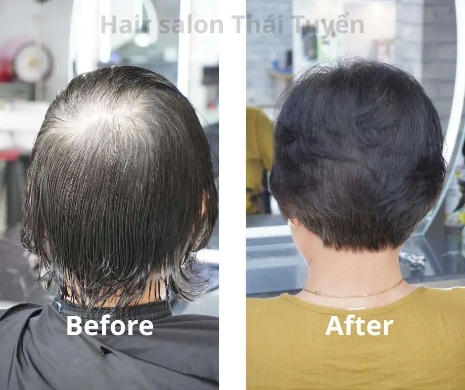 Tóc thưa mỏng
