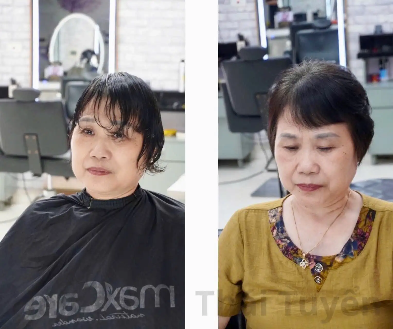 Tóc thưa mỏng